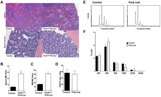 Figure 3. In vivo and in vitro megakaryopoiesis. (A) Sections of mouse spleen and femur bone marrow of control and FlnAloxP PF4-Cre mice were stained with H&E to reveal megakaryocytes. Sections shown are representative of 5 mice for each genotype. (B-C) Spleen and bone marrow MKs were quantified per field of view. Data represent the mean ± SD of 5 or 6 fields (5 mice for each genotype). *P < .05. (D) Percentage of CD61+ MKs differentiated from fetal livers in control and FlnA-null cultures. Results are expressed as mean ± SD (n = 8). (E) Ploidy analysis of fetal liver-derived control and FlnA-null MKs. Results are representative of 6 independent experiments. (F) Percentage of MK ploidy. Data are mean ± SD (n = 6). *P < .05.