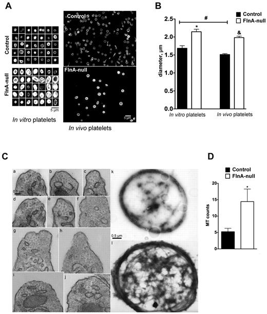 Figure 5. Microtubule coils in FlnA-null platelets. (A) Size of microtubule coils in control and FlnA-null platelets matured in vitro or in vivo. Microtubule coils were visualized by immunofluorescence for β-tubulin. Images are representative of 4 separate MK cultures and 3 mice. FlnA-null platelets had larger and brighter microtubule coils. (B) Quantification of platelet size. The diameters of microtubule coils were analyzed using MetaMorph Version 7.7 software. (C) Electron micrographs of mouse peripheral blood platelets in transverse sections show the increased number of microtubules in the marginal coils of FlnA-null platelets compared with controls: (i-v) control platelets; (vi-x) FlnA-null platelets. Electron micrographs of negative stained platelets show the increased thickness of the microtubule coils in FlnA-null platelets (xii) compared with control platelets (xi). Representative images of 3 independent experiments are shown. (D) Quantification of the number of microtubule coils in the marginal band in transverse images of thin sections of platelets. Results are mean ± SD (n = 10). *P < .05.
