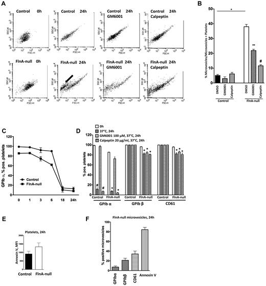 Figure 7. Microvesiculation of FlnA-null platelets. (A) Control or FlnA-null platelets were stored at 37°C for 24 hours with or without metalloproteinase inhibitor GM6001 (100μM), calpain inhibitor calpeptin (20 μg/mL), or DMSO as control, and analyzed by flow cytometry. Forward/side scatter dot plots shown are representative of 4 independent experiments. FlnA-null platelets release microvesicles after 24 hours of storage at 37°C (arrow). (B) Quantification of microvesicle formation. Results represent the percentage of microvesicle events over all events (microvesicles and platelets) and are mean ± SD (n = 4). *P < .05. (C) Expression of GPIbα on the surface of control and FlnA-null platelets stored for 24 hours at 37°C was analyzed by flow cytometry. GPIbα expression decreased on both control and FlnA-null platelets. (D) Effect of GM6001 and calpeptin on the surface expression of GPIbα on control and FlnA-null platelets. Data are expressed as percentage of positive platelets and are mean ± SD (n = 4). #P < .05 versus 0 hour control platelets. *P < .05 versus 0 hour FlnA-null platelets. (E) PS exposure was evaluated on control and FlnA-null platelets stored for 24 hours at 37°C by annexin V binding assay in flow cytometry. Results are expressed as MFI and are mean ± SD (n = 4). (F) FlnA-null microvesicles were analyzed for glycoprotein expression (GPIbα, GPIbβ, and CD61) and PS exposure (annexin V) at 24 hours. Results are expressed as percentage of positive microvesicles and are mean ± SD (n = 4).