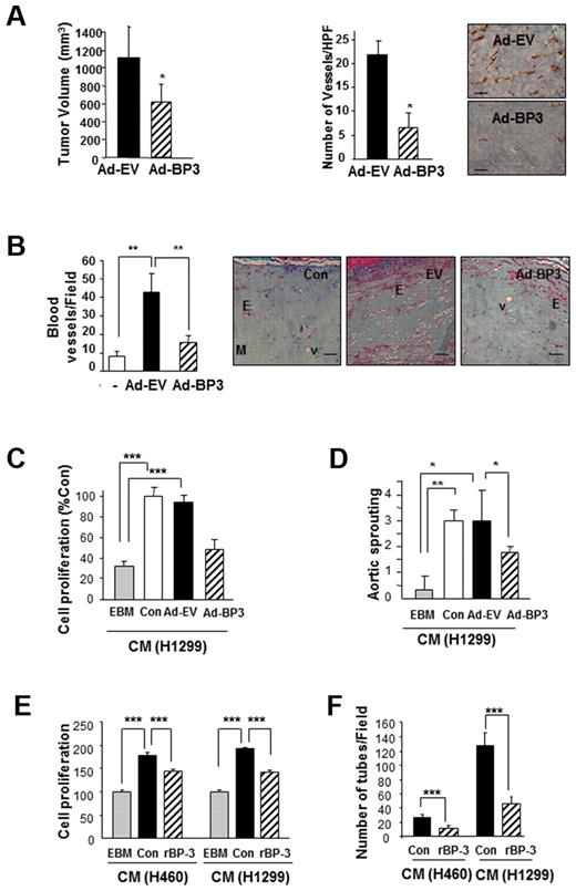 Figure 1. IGFBP-3 suppresses tumor growth and angiogenesis in NSCLC xenografts and vascular endothelial cells. (A) H1299 xenograft tumor growth (left) 10 days after injection with IGFBP-3–expressing adenoviruses (Ad-BP-3) or empty viruses (Ad-EV). Tumor growth is expressed as the mean ± SEM. An immunohistochemical analysis of CD31 (right) was performed in xenograft tissues, and the number of CD31-immunoreactive vessels per high-power field was counted. The results represent the mean calculated from 5 mice (bars, SDs). *P < .05 compared with the control group. Representative CD31 immunostaining in H1299 xenograft tissues is included. (B) Matrigel plug assay with A549 cells. Gross observed results of blood vessels are expressed as the mean of 5 tumors ± SEM, **P < .01. (C-D) Effect of CM from indicated NSCLC cell lines that had been infected with Ad-EV or Ad-BP-3 (C-D) or treated with rBP-3 (E-F) on HUVEC proliferation (C,E), chick aortic sprouting (D), and HUVEC tube formation (F). The results represent the means (bars, SDs) of 5 identical wells. *P < .05; **P < .01; ***P < .001.