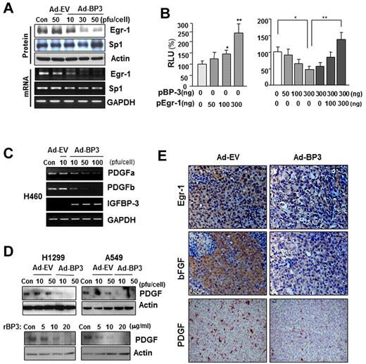 Figure 3. IGFBP-3 down-regulates bFGF expression promoter activity by regulating Egr-1 transcription. (A) Western blot (top) and semiquantitative RT-PCR (bottom) analyses of IGFBP-3's effect on Egr-1 and Sp-1 protein and mRNA expression in H460 cells that had been infected with Ad-BP-3 or Ad-EV for 2 days. (B) Luciferase assay to determine Egr-1's effect on bFGF expression. H460 cells transiently transfected with bFGF-Luc and pEgr-1, pBP-3, or both; *P < .05, **P < .01. (C-D) RT-PCR analysis of PDGFa and PDGFb mRNA expression in H460 cells (C) and Western blot analysis of PDGF protein expression in H1299 and A549 cells (D) after infection with Ad-EV or Ad-BP-3 or treatment with rBP-3. (E) Immunohistochemical analysis of Egr-1, bFGF, and PDGF expression in H1299 xenografts 10 days after injection with Ad-EV or Ad-BP-3.