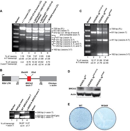 Figure 4. Expression of BRCA2 Δexons 4-7 transcript in human cell lines carrying IVS7 + 2T > G or another truncation mutation at exon 7. (A) RT-PCR analysis of different human cell lines: GM05920B (+/+ LCL), AVO35 (+/IVS7 + 2T > G LCL), AC389 (c.3827delGT/IVS7 + 2T > G fibroblast), SB1685CB (c.3827delGT/IVS7 + 2T > G leukemia), and GM14805 (+/W194X LCL). (B) RHCglo minigene reporter construct is shown in the left panel. BRCA2 exon7 variants replaced the RHCglo exon. Wild-type (WT) and W194X (c.809G > A) mutated were PCR-amplified using overlapping oligonucleotides containing WT or mutated sequences and BamHI and XhoI flanking restriction sites. Primers used for RT-PCR are marked by arrows and indicated as pF and pR. RT-PCR analysis of BRCA2 exon 7 alternative splicing in RHCglo minigene is shown at right. (C) Expression of Δexon 7 and Δexons 4-7 transcripts in ES cells carrying the W194X BRCA2 transgene. (D) WB showing the expression of BRCA2Δexons 4-7 variant in W194X ES cells. Actin was used as a loading control. (E) Methylene blue staining of HATr colonies obtained after Cre expression into the ES cells expressing either WT or W194X BRCA2.
