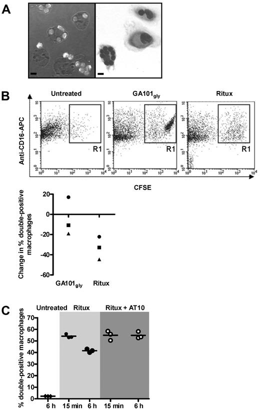 Figure 5. FcγRIIb inhibition promotes phagocytosis of rituximab-treated CLL cells. (A) Phagocytosis assays: CFSE-labeled CLL cells were treated with GA101gly for 6 hours and then added to normal human macrophages for phagocytosis. Representative images are shown by confocal microscopy (left) and after May-Grünwald-Giemsa staining by bright field microscopy (right). Bar represents 10 μm. A Leica TCS-SP5 laser scanning confocal miscroscope (10× eye piece, 40× objective oil immersion lens) and Olympus CKX21 inverted microscope with 10×/0.25PH lens with 40× objective oil immersion lens was used, respectively. (B) The assay in panel A was repeated but CFSE-labeled CLL cells were treated with either GA101gly or rituximab for 15 minutes or 6 hours before adding to the macrophages. Anti–CD16-APC was used to identify the macrophages, and results were analyzed by flow cytometry. Representative dot plots are shown for untreated and treated cells (top panels). Double-positive cells include both macrophages that have phagocytosed CFSE-labeled CLL cells, and also macrophages that have them rosetted on their surface. However, visual analysis of confocal images as in panel A suggests that > 90% of the CFSE-labeled CLL cells have been phagocytosed. The graph (bottom panel) shows the reduction in the % double positive cells between 15 minutes and 6 hours. Each point shows the mean of triplicate samples, and 3 different CLL patients are shown. Different symbols are used to identify samples from the same patients. (C) As in panel B, but CLL cells were treated with rituximab only, or in combination with AT10 F(ab′)2 for 15 minutes or 6 hours and phagocytosis measured. Triplicate samples are shown; the experiment has been repeated twice.