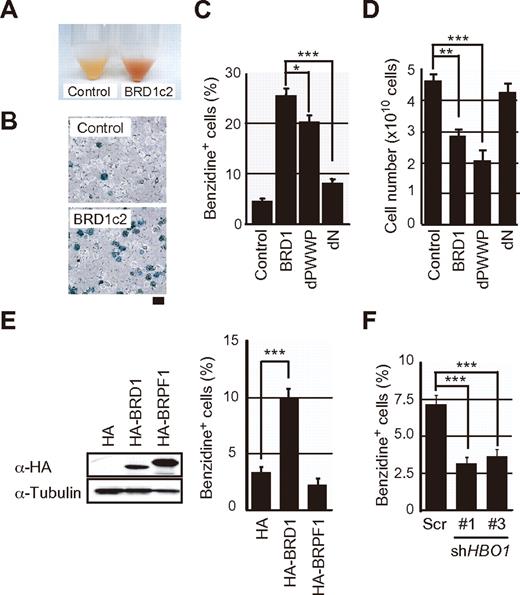 Figure 4. Overexpression of BRD1 induces erythroid differentiation in K562. (A) Appearance of parental K562 cells (Control) and the Flag-BRD1-expressing clone (BRD1c2) used for purification of the BRD1 complex. (B) Benzidine staining of parental K562 cells (Control) and Brd1c2. The bar indicates 20 μm (C) Benzidine staining of K562 cells expressing BRD1 mutants. K562 cells were transduced with an empty vector (Control) or retroviruses expressing full-length BRD1 (BRD1), dPWWP, or dN. Transduced cells were sorted with the use of GFP as a marker antigen and expanded for benzidine staining. Bars represent mean ± SE (n = 12). (D) Growth of K562 cells expressing BRD1 or the BRD1 mutant in (C). The results are shown as the mean ± SE for triplicate cultures. (E) Overexpression of BRPF1 in K562 cells. K562 cells were transduced with a HA-BRPF1 retrovirus, and BRPF1 expression was detected by Western blotting by use of the anti-HA antibody (left). Effects of BRPF1 on erythroid differentiation of K562 cells were evaluated by benzidine staining. The data are shown as the mean ± SE for triplicate cultures. (F) Knockdown of HBO1 with the use of shRNA. K562 cells were infected with lentiviruses expressing shRNAs against HBO1 and analyzed as to the basal status of hemoglobinization by benzidine staining. The results are shown as the mean ± SE for triplicate cultures. *P < .05, **P < .005, ***P < .0005.