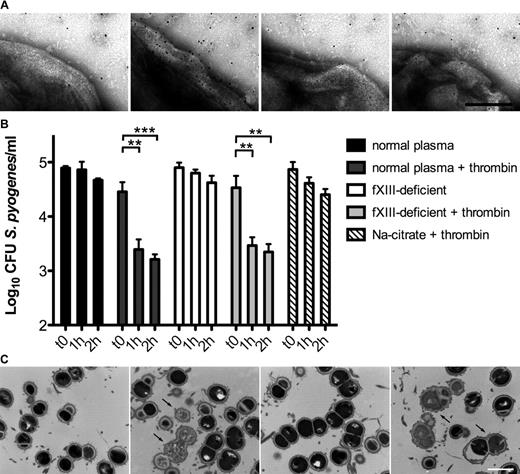 Figure 1. The contact system is activated on the bacterial surface after exposure to plasma, leading to antimicrobial activity. (A) S pyogenes AP1 bacteria were incubated in sodium citrate alone or in normal, fXII-, or fXIII-deficient plasma (all diluted 1:100 in sodium citrate) in the presence of ZnCl2, CaCl2, phospholipids, and the gold-labeled antibody against N-ϵ-γ-glutamyl-lysine for 15 minutes, and then analyzed by negative-staining electron microscopy. The scale bar indicates 100 nm. (B) S pyogenes AP1 bacteria were incubated in nonactivated or thrombin-activated normal and fXIII-deficient plasma (1:100 diluted). At the indicated time points, bacterial numbers were determined by plating of serial dilutions onto blood agar. Bacteria incubated in sodium citrate in the presence of thrombin served as controls. The data represent the means ± SD of 3 independent experiments. **P < .01; ***P < .001. (C) AP1 bacteria were incubated with normal or fXIII-deficient plasma and clotting was initiated by the addition of thrombin. Thin-sectioned clots before (0h) and after 1 hour (1h) of incubation at 37°C are shown. Similar amounts of dead bacteria (arrows) were detected in both samples after incubation. The scale bar indicates 1 μm.