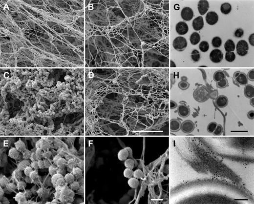 Figure 2. Entrapment and immobilization of S pyogenes inside the clot. Scanning electron micrographs showing the structure of clots generated from normal plasma (A,C,E) or fXIII-deficient plasma (B,D,F) in the absence (A-B) or presence (C-F) of bacteria. The scale bars indicate 10 μm in panels A through D and 1 μm in panels E and F. The transmission electron micrographs depict S pyogenes alone (G), after exposure to thrombin-activated plasma (H), and after exposure to plasma followed by immunostaining with a gold-labeled N-ϵ-γ-glutamyl-lysine antibody recognizing the fXIII cross-linking site (I). Scale bars indicate 1 μm in panels G and H and 100 nm in panel I.