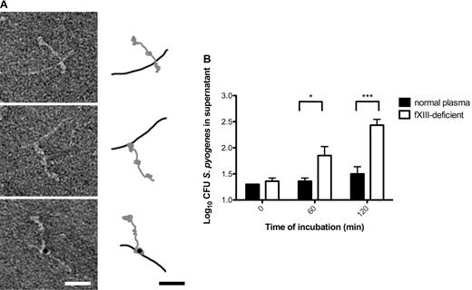 Figure 3. fXIII cross-links the streptococcal M1 protein with fibrinogen, leading to immobilization of bacteria within the clot. (A) The electron micrographs show negatively stained human fibrinogen (characterized by 3 domains) in complex with M1-protein (elongated) before (top) and after fXIII cross-linking (middle). Cross-linking was detected by immunostaining the fibrinogen M1 protein complex with the gold-labeled antibody against N-ϵ-γ-glutamyl-lysine (bottom). A schematic drawing of the fibrinogen (gray) and M1 protein (black) is included to highlight the interaction between fibrinogen and M1 protein. The scale bars indicate 25 nm. (B) Bacteria were incubated with normal or fXIII-deficient plasma and clotting was initiated by the addition of thrombin. Clots were washed briefly, covered with THB medium, and further incubated at 37°C. At the indicated time points, bacterial numbers were determined by plating of serial dilutions of the supernatant onto blood agar. The data represent the means ± SD of 3 independent experiments. *P < .05; ***P < .001.