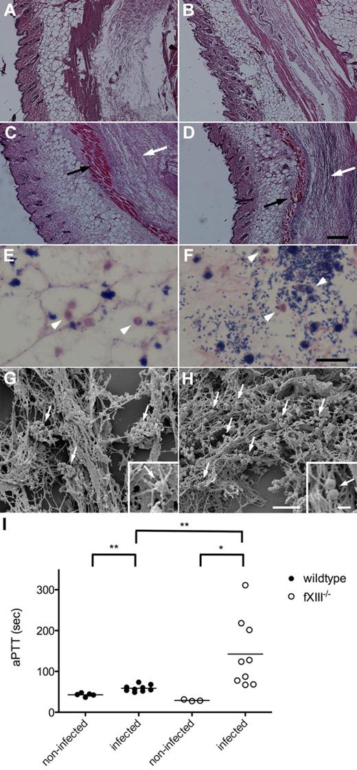 Figure 4. Subcutaneous infection of wild-type and fXIII−/− mice with S pyogenes. H&E–stained representative tissue sections from noninfected (A-B) and infected (24 hours after infection; C-D) wild-type (A,C) and fXIII−/− (B,D) mice are shown. Infected animals show signs of inflammation (white arrows) and tissue damage (black arrows). The scale bar indicates 500 μm. Giemsa-stained biopsies from the inflamed area of wild-type (E) and fXIII−/− mice (F) are shown. Arrowheads point to infiltrating inflammatory cells (macrophages/neutrophils). The scale bar indicates 25 μm. Scanning electron micrographs depict biopsies from wild-type (G) and fXIII−/− (H) mice. Arrows indicate bacteria entrapped and clustered within the fibrin meshwork in wild-type mice (G) and scattered throughout the infection area in fXIII−/− animals (H). Scale bars indicate 10 μm in the figure and 1 μm in the insets. (I) aPTT measured in plasma from noninfected and infected wild-type and fXIII−/− mice (24 hours after infection). Data are presented as mean values of plasma samples obtained from 3 or 5 noninfected and 9 infected animals obtained from 3 independent experiments. *P < .05; **P < .01.