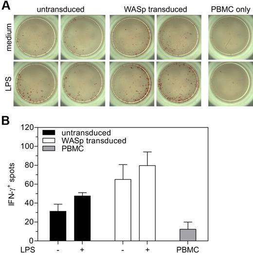 Figure 7. Restoration of T-cell priming after reconstitution of WASp expression in human cells. (A) Analysis of IFN-γ production by ELISPOT. (B) Quantification of the number of IFN-γ positive spots in panel A. Data are shown as averages ± SD from 1 experiment performed in triplicate.