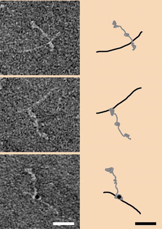 The electron micrographs (left side) are of negatively stained human fibrinogen complexed with the M1 protein of S pyogenes before (top) and after factor XIII–induced cross-linking (middle). Cross-linking detected with gold-labeled antibody is shown in the bottom panel. Corresponding interpretive schematics are shown on the right side. Taken from Figure 3A in Loof et al, page 2589.1