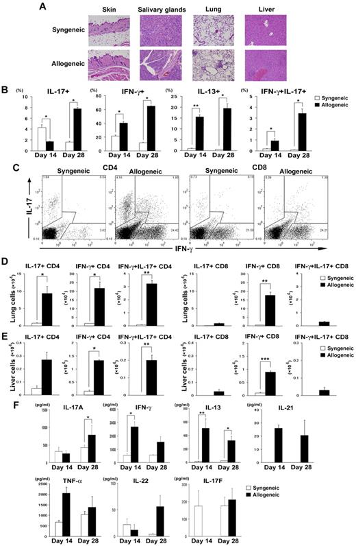 Figure 1. Th17 cells are increased in lymphoid organs during the late phase of cGVHD. Sublethally irradiated (6.75 Gy) BALB/c mice were transplanted with 2 × 106 spleen T cells plus 8 × 106 TCD-BM from WT B10.D2 mice (allogeneic group; black bars). The syngeneic group (white bars) received a transplant of the same dose of splenocytes and TCD-BM from BALB/c mice. (A) Histopathology of skin, salivary glands, lung, and liver of syngeneic and allogeneic recipients 35 days after BMT. (B) The percentages of donor-derived CD3+ T cells expressing IL-17, IFN-γ, IL-13, and IFN-γ/IL-17 on days 14 and 28 are shown. (C) Representative staining for intracellular IFN-γ and IL-17 on CD4+ and CD8+ T cells on day 28 for syngeneic and allogeneic mice. (D-E) Absolute numbers of IL-17–, IFN-γ–, and IFN-γ/IL-17–producing CD4+ and CD8+ T cells in recipient lung (D) and liver (E). (F) PLN cells from syngeneic and allogeneic recipients on days 14 and 28 were stimulated with PMA and ionomycin in vitro. Five hours later, the supernatants were collected to determine cytokine levels by ELISA or CBA. Graphs indicate the levels of cytokines secreted per 1 × 106 total stimulated PLN cells. Three to 6 mice per group were used. The means (± SE) of each group are shown. Data are from 1 representative of ≥ 2 independent experiments. *P < .05, **P < .01, and ***P < .005.