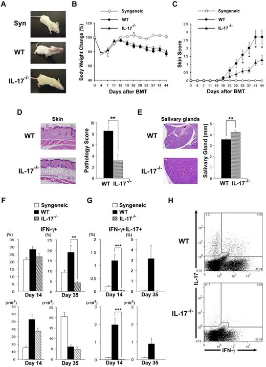 Figure 2. IL-17−/− donor T cells ameliorate cGVHD. Sublethally irradiated BALB/c recipients were transplanted from WT, IL-17−/− B10.D2, or syngeneic BALB/c donors. (A) Gross observation of the skin lesions from recipients of syngeneic, WT, and IL-17−/− donors 28 days after BMT. The recipients were analyzed for body weight (B) and cGVHD skin scores (C); data from 2 independent experiments were combined (n = 14 per group). Pathology score of skin (D) and the longest diameter of the salivary gland (E) on day 35 of BMT are shown. Four to 6 recipients were examined in each group. (F-G) PLN cells of the recipients of syngeneic (white bar), WT (black bar), or IL-17−/− (striped bar) donors were stained for intracellular IFN-γ and IL-17 on days 14 and 35 after BMT. The percentages and absolute numbers of IFN-γ+ cells (F) and IFN-γ+/IL-17+ cells (G) are shown. Data from 2 replicated experiments were combined (n = 6-11 per group). (H) Representative staining for intracellular IFN-γ and IL-17 on CD4+ T cells of WT or IL-17−/− mice on day 35 is shown. Data represent the means ± SEs. *P ≤ .05, **P ≤ .01, and ***P ≤ .001.