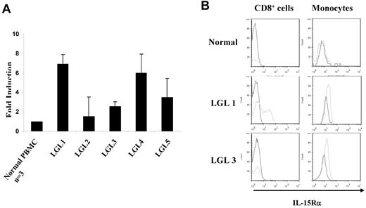 Figure 3. Increased expression of IL-15Rα in the PBMCs from patients with T-LGL leukemia. (A) TaqMan real-time RT-PCR analysis of IL-15Rα mRNA levels in the PBMCs from patients with T-LGL leukemia. The copy numbers of IL-15Rα mRNA were normalized to the copy number of HPRT1 mRNA. The fold induction was calculated based on the normalized IL-15Rα mRNA copy number in PBMCs from normal donors (n = 3). (B) FACS analysis of the cell surface expression of IL-15Rα on both CD8+ T cells and monocytes in PBMCs from T-LGL leukemic patients compared with those from normal donors. The data from patient LGL1 are representative of those from 2 T-LGL patients who showed IL-15Rα expression on both CD8+ cells and monocytes. The data from patient LGL3 are representative of those from patients that showed IL-15Rα expression on monocytes alone. CD14 was used as the monocyte marker.