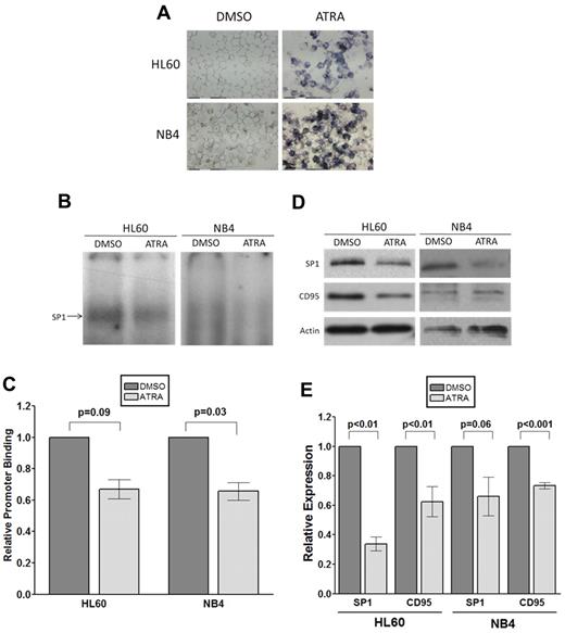 Figure 4. ATRA-induced differentiation of AML cells downregulates SP1 promoter binding and CD95 expression. (A) Assessment of HL60 and NB4 ATRA-induced differentiation by NBT reduction assay. Cells were treated with 10μM ATRA or vehicle only (DMSO) for 48 hours. After treatment, cells were resuspended in 3 × 10−7M phorbol 12-myristate 13-acetate diluted in 1 mg/mL NBT solution. Cytospins were prepared from 100 μL of each cell suspension, with blue staining in ATRA-treated cells indicative of phagocytic capability and therefore confirming differentiation. (B-C) EMSA illustrating down-regulation of SP1 binding to the polymorphic site in the CD95 core promoter after ATRA treatment. (B) 32P-labeled CD95 −1377 DNA probe (G allele, all lanes) was incubated with 15 μg HL60 or NB4 nuclear extract from cells treated with 10μM ATRA or vehicle alone (DMSO). (C) SP1 binding was quantified using densitometry. Error bars represent the mean ± SEM from 3 independent experiments, and statistical analysis was performed using the unpaired Student t test. (D-E) ATRA-induced differentiation of HL60 and NB4 down-regulates SP1 and CD95 expression. HL60 or NB4 cells were incubated with 10μM ATRA or vehicle-alone (DMSO). Down-regulation of SP1 and CD95 protein expression was confirmed by immunoblot analysis (D) and quantified using densitometry (E). Error bars represent the mean ± SEM from at least 3 independent experiments, and statistical analysis was performed using the unpaired Student t test (E).