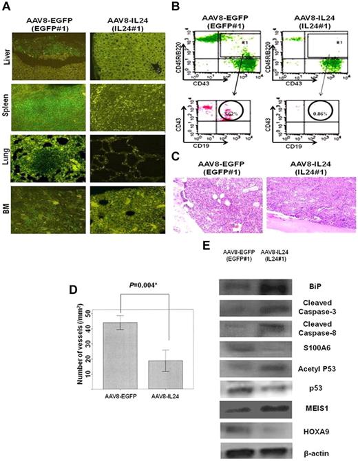 Figure 4. Results of therapy with AAV8-IL24 in MLL/AF4 Tg mice. (A) Comparison of the results of immunohistopathologic analysis between one mouse from the AAV8-IL24 group and one mouse from the AAV8-EGFP group. Although CD45R/B220+ pro-B-cell lymphoma/leukemia infiltration (green fluorescence) was observed in the liver, lung, spleen, and BM in EGFP#1 (AAV-EGFP group), no lymphoma/leukemia infiltration was observed in IL24#1 (AAV-IL24 group). (B) Comparison of the results of FACS analysis of PB between 1 mouse from the AAV8-IL24 group and 1 mouse from the AAV8-EGFP group. FACS analysis showed that CD45R/B220+CD19+CD43+ leukemia cells accounted for 3.62% of WBC in IL24#1 (AAV-IL24 group), but only 0.86% of WBCs in EGFP#1 (AAV-EGFP group). (C) H&E-stained BM sections from MLL/AF4 Tg mice (AAV8-EGFP group vs AAV8-IL24 group). (D) Comparison of the number of microvessels in MLL/AF4 Tg mice (AAV8-EGFP group vs AAV8-IL24 group). The number of microvessels in MLL/AF4 Tg mice transduced with AAV8-IL24 was significantly decreased in comparison with MLL/AF4 Tg mice transduced with AAV8-EGFP (18.6 ± 6.1/mm2 vs 44.0 ± 4.0/mm2, P = .004). (E) WB analysis confirmed in vivo that up-regulated S100A6 and HOXA9 were inhibited and p53 acetylation, MEIS1, BiP, cleaved caspase 8, and cleaved caspase 3 were activated in the AAV8-IL24 group.