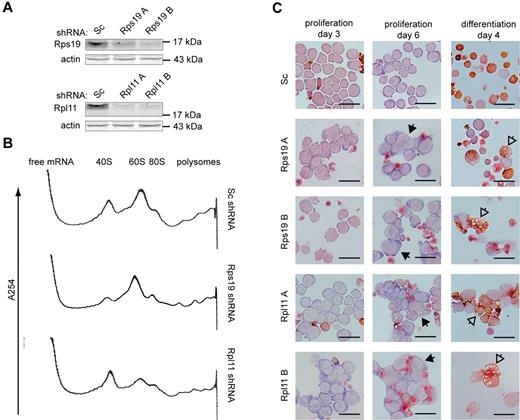 Figure 1. Phenotype of Rps19- and Rpl11-deficient erythroblasts. (A) Rps19 and Rpl11 protein levels in I/11 erythroblasts 3 days after transduction with lentiviral vectors expressing scrambled (Sc) shRNA or 2 distinct shRNAs (A-B) specific for Rps19 or Rpl11, respectively. (B) RNA profiles measured by absorbance at 254 nm in a sucrose gradient loaded with cytoplasmic extract of shRNA-treated erythroblasts 3 days after transduction. The positions of the 40S and 60S ribosomal subunits, the 80S monosome, and polysomes are indicated (for peak identification, see supplemental Figure 1). (C) I/11 erythroblasts were transduced with lentiviral shRNA constructs as indicated. Cells were cultured for 3 days (left panel) and 6 days (middle panel) in proliferation conditions or switched to differentiation conditions 3 days after transduction and differentiated for 4 days (right panel). Cells were stained for hemoglobin (brown) and histological dyes. Full arrowheads point to multinucleated cells; empty arrowheads point to aberrantly differentiated cells. Scale bars represent 25 μm.