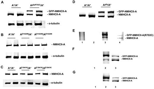 Figure 1. Immunoblot analysis of NMHCII-A expression levels in adult mouse lung tissue. (A) Analysis of NMHCII-A expression from extracts of A+/A+ and AgfpR702C/A+ mouse lung. Note that mutant GFP–NMHCII-A protein migrates more slowly than endogenous NMHCII-A. Mutant GFP–NMHCII-A and endogenous NMHCII-A were detected with anti–NMHCII-A. In the AgfpR702C/A+ lung tissue, the expression level of the GFP–NMHCII-A R702C is ∼ 80% of the endogenous NMHCII-A. There are 2 different loadings for each sample. (B) Immunoblot analysis of NMHCII-A expression in A+/A+, AD1424N/A+, and AD1424N/AD1424N tissue shows that approximately the same amount of NMHCII-A protein, normalized to tubulin, is expressed in the A+/A+, AD1424N/A+, and AD1424N/AD1424N mouse lung. (C) Immunoblot analysis of NMHCII-A expression in A+/A+, AE1841K/A+, and AE1841K/AE1841K lung shows that similar amounts of NMHCII-A are expressed normalized to tubulin. (D) Immunoblot analysis of NMHCII-A expression in Agfp/A+ lungs also shows similar expression of GFP–NMHCII-A compared with NMHCII-A. (E) Evidence for heterodimer formation in AgfpR702C/A+ mouse tissue. High-salt lysates of AgfpR702C/A+ lung tissue were incubated with anti-GFP, and the immunoprecipitate was subject to SDS-PAGE followed by immunoblotting with NMHCII-A Ab. Lane 1 indicates A+/A+ lysate immunoprecipitated with anti-GFP shows no immunoprecipitate; lane 2, AgfpR702C/A+ lysate treated with beads without Ab shows no immunoprecipitate; lane 3, AgfpR702C/A+ lysate immunoprecipitated with anti-GFP shows a 4-fold increase in GFP–NMHCII-A R702C compared with NMHCII-A; and lane 4, AgfpR702C/A+ lysate input showing endogenous NMHCII-A (bottom band) and GFP–NMHCII-A R702C (top band). The signal intensity ratio between the top band and bottom band of lane 3 is 4.09 ± 0.69 (n = 3), ratio for lane 4 is 0.81 ± 0.13 (n = 3). Relative intensity of signal was determined with ImageJ (NIH). (F,G) Immunoprecipitation from Agfp/A+ lung (F, lane 2) and leukocytes (G, lane 2) shows 5.25 ± 0.35 (n = 2) and 3.94 (n = 1) ratio of GFP–NMHCII-A to NMHCII-A, respectively. Lane 1 is immunoprecipitation with beads but without Ab, lane 2 is the immunoprecipitate with anti-GFP, and lane 3 is input.