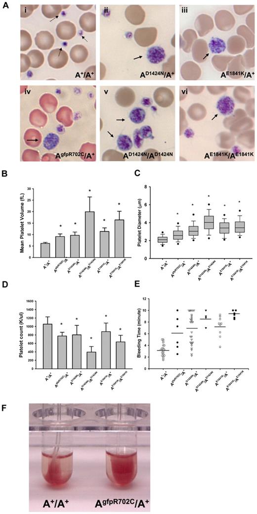 Figure 2. Platelet analyses in NMII-A mutant and control mouse blood. (Ai) Blood smear from an A+/A+ mouse shows normal size platelets (arrows), approximately one-tenth the diameter of erythrocytes. (Aii-vi) Giant platelets (arrows) with a size close to that of erythrocytes were easily detected in blood smears from all 3 mutant mouse lines. Blood smears are stained with Wright-Giemsa stain. (B) Mean platelet volumes (MPVs) of circulating platelets. MPVs from heterozygous and homozygous mutant mice are all significantly larger than the MPV from A+/A+ mice. Results represent mean ± SD. A+/A+ MPVs: 6.15 ± 0.45 fL (n = 18); AgfpR702C/A+: 9.13 ± 1.16 fL (n = 12); AD1424N/A+: 9.67 ± 1.44 fL (n = 10); AD1424N/AD1424N: 19.95 ± 6.45 fL (n = 4); AE1841K/A+: 11.37 ± 1.53 fL (n = 13); and AE1841K/AE1841K: 16.40 ± 3.75 fL (n = 3). *P < .001, 1-way ANOVA compared with A+/A+. (C) Platelet diameters measured from peripheral blood smears. Platelet diameters (mean ± SD) of A+/A+: 2.12 ± 0.45 μm (n = 193); AgfpR702C/A+: 2.67 ± 0.78 μm (n = 225); AD1424N/A+: 3.19 ± 0.93 μm (n = 110); AD1424N/AD1424N: 4.01 ± 1.09 μm (n = 114); AE1841K/A+: 3.41 ± 0.88 μm (n = 169); and AE1841K/AE1841K: 3.63 ± 1.01 μm (n = 158). The box plot shows median, upper and lower quartiles, and upper and lower 5 percentiles of each group. *P < .001 1-way ANOVA compared with A+/A+. Platelet diameter was measured on images of Wright-Giemsa–stained blood smears with the use of ImageJ (NIH). (D) Platelet counts from peripheral blood. Platelet counts from heterozygous NMII-A mutant mice are all significantly lower than those of A+/A+ mice, and homozygous mutant mice have even lower platelet counts. Results represent mean ± SD. Circulating platelet counts of A+/A+: 1056.29 ± 172.23 K/μL (n = 21); AgfpR702C/A+: 774.67 ± 88.02 K/μL (n = 12); AD1424N/A+: 801.90 ± 225.76 K/μL (n = 22); AD1424N/AD1424N: 395.40 ± 131.80 K/μL (n = 5); AE1841K/A+: 878.79 ± 202.31 K/μL (n = 14); and AE1841K/AE1841K: 635.33 ± 157.15 K/μL (n = 3). *P < .001, 1-way ANOVA compared with A+/A+. (E) Tail bleeding times. Mutant mice have a prolonged tail bleeding time compared with A+/A+ mice. Bar indicates mean of each group. (F) Clot retraction test. Representative image shows that the AgfpR702C/A+ platelet sample (in right tube) has reduced clot retraction compared with the A+/A+ sample (left tube). Image was taken 3 hours after stimulation.