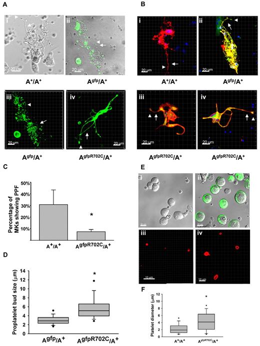 Figure 4. MK culture and PPF from fetal liver. (A) Live-cell images of MKs cultured from fetal liver of A+/A+, Agfp/A+, and AgfpR702C/A+ embryos. Phase image is shown for A+/A+ (Ai), fluorescence/DIC overlay image for Agfp/A+ (Aii), and fluorescence z-stack images for Agfp/A+ (Aiii) and AgfpR702C/A+ (Aiv). Arrows indicate proplatelets; arrowheads, platelet buds; green: GFP. Bar, 20μm. (B) Fixed MK cultures stained with anti-CD41 to confirm the identity of the MKs. Note the difference in the length and thickness of the proplatelets (arrows) and the size of the proplatelet buds (arrowheads) between control (Bi-ii) and AgfpR702C/A+ (Biii-iv) MKs. Red indicates CD41; and green, GFP. Bar, 20 μm. (C) Percentage of MKs undergoing PPF in culture (mean ± SD). A+/A+: 30.8% ± 12.6% (n = 5); and AgfpR702C/A+: 7.4% ± 1.9% (n = 9). *P < .001 (t test). (D) Proplatelet bud size in culture. Measurements of the diameters of proplatelet buds are from the confocal microscope images of live Agfp/A+ and AgfpR702C/A+ MKs. Box plot shows median, upper and lower quartiles, and upper and lower 5 percentiles of each group. Agfp/A+: 3.07 ± 1.05 μm (n = 199); and AgfpR702C/A+: 5.84 ± 2.73 μm (n = 107); *P < .001 (t test). (E) In vitro production of platelets from A+/A+ and AgfpR702C/A+ embryonic littermate MKs. DIC imaging shows A+/A+ (Ei) and AgfpR702C/A+ (Eii; GFP signal included) MKs separated from 4-day fetal liver culture by 1.5%-3.0% BSA gradient before PPF; (Eiii-iv) immunofluorescence staining with CD41 Ab to identify platelets after in vitro platelet production by shaking at 150 rpm for 2 hours at 37°. (F) Quantitation of platelet diameter from A+/A+ and AgfpR702C/A+ in vitro platelet production.