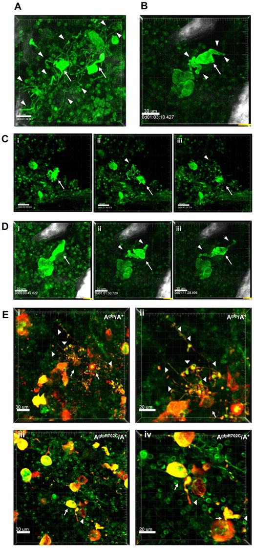 Figure 5. Live tissue imaging of BM from Agfp/A+ and AgfpR702C/A+ mice. (A) Representative 3D images of MKs in control Agfp/A+ BM (n = 9). There are 2 MKs (arrows) forming proplatelets (arrowheads indicate some of the proplatelets). The well-developed multiple branches of proplatelets and the multiple buds are similar to those seen in culture. Bar, 30 μm. (B) Representative 3D image from a video showing a MK (arrow) during PPF in AgfpR702C/A+ BM (n = 7). The mouse shown was injected with 1 ng TPO/g of body weight 3 days before imaging to increase possibility of visualizing PPF.21 Proplatelets are shorter and thicker than those seen in panel A. White signal is due to bone collagen SHG. Bar, 30 μm. (C) Snapshot from supplemental Video 2 of a MK (arrow) in Agfp/A+ BM. Proplatelets and buds are indicated by arrowheads. Bar, 40 μm. (D) Snapshots from a video showing PPF from a MK (arrow) in AgfpR702C/A+ BM. There are fewer branches and buds on proplatelets (arrowheads; supplemental Video 5). White signal is because of bone collagen SHG. Bar, 30 μm. (E) Fixed BM confirming MK identity by CD41 staining in Agfp/A+ (Ei-ii) and AgfpR702C/A+ (Eiii-iv) BM. (Eii,iv) Shown are increased magnification of panel Ei,iii. Arrows indicate MKs; arrowheads, proplatelets; red, CD41; green, GFP. Bar, 30 μm (Ei,iii) and 20 μm (Eii,iv).