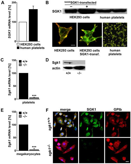 Figure 1. SGK1 mRNA and protein expression in human as well as in murine platelets and megakaryocytes. (A) Quantitative RT-PCR of mRNA encoding SGK1 in human platelets and HEK293 cells. (B) Western blot and confocal microscopy of SGK1 abundance in human platelets, nontransfected and S422DSGK1-transfected HEK293 cells. Red represents actin; and green, SGK1. Bar represents 5 μm. (C) Arithmetic mean ± SEM (n = 4) of mRNA encoding SGK1 in platelets from sgk1−/− mice expressed in percentage of the respective value in platelets from sgk1+/+ mice. ***P < .001. (D) Representative Western blot analysis of SGK1 protein abundance in platelets from sgk1+/+ and sgk1−/− mice. (E) Arithmetic mean ± SEM (n = 4) of mRNA encoding SGK1 in megakaryocytes from sgk1−/− mice expressed in percentage of the respective value in megakaryocytes from sgk1+/+ mice. ***P < .001. (F) Confocal microscopy of SGK1 protein abundance in megakaryocytes from sgk1+/+ (top) and sgk1−/− (bottom) mice. Red represents glycoprotein Ib; green, SGK1; and blue, nuclei. Bar represents 10 μm.