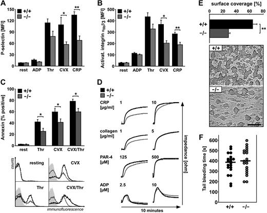 Figure 2. Activation-dependent platelet degranulation, αIIbβ3integrin activation, phosphatidylserine exposure, and aggregation as well as in vitro thrombus formation and tail bleeding time. (A) Flow cytometric analysis of degranulation-dependent P-selectin exposure in platelets from sgk1+/+ (black bar) and sgk1−/− (gray bar) mice in response to 10μM ADP, 0.02 U/mL thrombin, 1 μg/mL CVX, and 5 μg/mL CRP. Arithmetic mean ± SEM (n = 6). *P < .05. **P < .01. (B) Flow cytometric analysis of αIIbβ3 integrin activation in platelets from sgk1+/+ (black bar) and sgk1−/− (gray bar) mice in response to 10μM ADP, 0.02 U/mL thrombin, 1 μg/mL CVX, and 5 μg/mL CRP. Arithmetic mean ± SEM (n = 6). *P < .05. **P < .01. (C) Flow cytometric analysis of phosphatidylserine exposure in platelets from sgk1+/+ (black bar) and sgk1−/− (gray bar) mice in response to 1.0 U/mL thrombin, 1 μg/mL CVX, and 0.05 U/mL thrombin + 0.5 μg/mL CVX. (Top) Arithmetic mean ± SEM (n = 9). *P < .05. (Bottom) Representative overlays of annexin-positive sgk1+/+ (black line) and sgk1−/− (gray line) platelets. Light gray panels represent isotype controls. (D) Impedance aggregometry after stimulation with different concentrations of CRP (1 and 10 μg/mL), collagen (1 and 5 μg/mL), PAR-4 activating peptide (125 and 500μM), and ADP (2.5 and 10μM). Representative aggregation tracings of sgk1+/+ (black line) and sgk1−/− (gray line) mice (n = 4). (E) Thrombus formation in vitro. Whole blood from sgk1+/+ and sgk1−/− mice was perfused over a collagen-coated surface for 5 minutes at a shear rate of 1700s−1. Arithmetic mean ± SEM (n = 6; top) and representative phase-contrast images (bottom) of surface coverage. **P < .01. Bar represents 50 μm. (F) Tail bleeding time measured after amputating the tail tip of sgk1+/+ and sgk1−/− mice. Each dot represents 1 mouse; black bar represents the mean value.