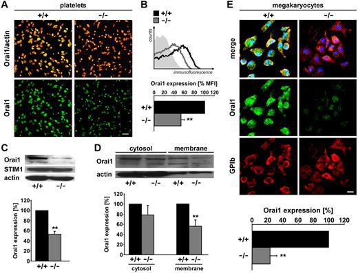 Figure 4. Orai1 protein abundance in sgk1−/− and sgk1+/+ platelets and megakaryocytes. (A) Confocal microscopy of Orai1 protein abundance in platelets from sgk1+/+ (left panels) and sgk1−/− (right panels) mice. Red represents actin; and green, Orai1. Bar represents 10 μm. (B) Flow cytometric analysis of Orai1 surface expression in platelets from sgk1+/+ (black bar) and sgk1−/− (gray bar) mice. (Bottom) Arithmetic mean ± SEM (n = 7). **P < .01. (Top) Representative overlays of Orai1-positive sgk1+/+ (black line) and sgk1−/− (gray line) platelets; light gray panel represents isotype control. (C) Western blot analysis of whole cell lysate protein of Orai1 and STIM1 from sgk1+/+ and sgk1−/− platelets. Arithmetic mean ± SEM (n = 4) of Orai1 protein abundance in sgk1+/+ (black bar) and sgk1−/− (gray bar) platelets. **P < .01. (D) Western blot analysis of isolated membrane protein and cytosolic fraction of Orai1 from sgk1+/+ and sgk1−/− platelets. Arithmetic mean ± SEM (n = 4) of Orai1 protein abundance in sgk1+/+ (black bars) and sgk1−/− (gray bars) platelets. **P < .01. (E) Confocal microscopy of Orai1 protein abundance in megakaryocytes cultivated from bone marrow of sgk1+/+ (left panels) and sgk1−/− (right panels) mice (top). Red represents GPIb; green, Orai1; and blue, nuclei. Bar represents 10 μm. Statistical analysis of Orai1 immunofluorescence abundance (bottom). **P < .01. n = 4.