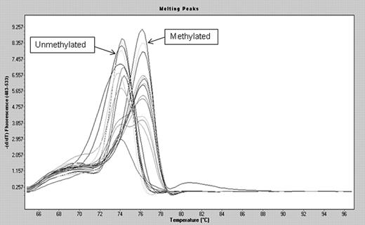 Figure 5. Allelic methylation levels in del 5q AML/MDS patients. BM MNCs from del(5q) patients preferentially carry either a methylated or an unmethylated allele, suggesting their origin from normal cells with either a methylated or an unmethylated VTRNA2-1. The bimodal melting profile seen in a few cases is likely caused by normal MNCs in the sample.