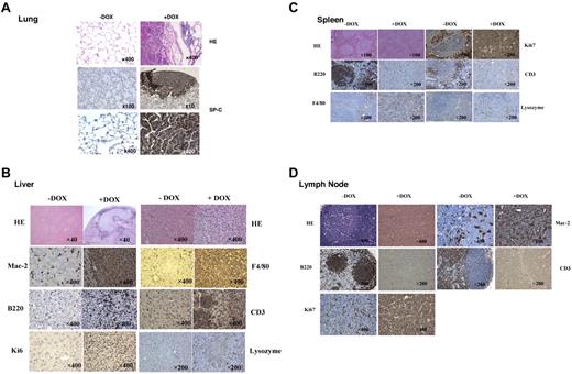 Figure 7. Tumorigenesis in c-fms-rtTA/(tetO)7-CMV-dnPPARγ–bitransgenic mice. (A) H&E and immunohistochemical staining of lung tissue sections with anti–SP-C Ab in the tumor areas of doxycycline-treated bitransgenic mice. Untreated mice served as controls. (B) H&E and immunohistochemical staining of liver tissue sections with anti-Mac2, F4/80, B220, CD3, Ki67, and lysozyme Abs in the tumor areas of doxycycline-treated bitransgenic mice. Untreated mice served as controls. Original magnifications were 40×, 200×, and 400×. (C) H&E and immunohistochemical staining of spleen tissue sections with anti-Ki67, B220, CD3, F4/80, and lysozyme Abs in the tumor areas of doxycycline-treated bitransgenic mice. Untreated mice served as controls. Original magnifications were ×100 and ×200. (D) H&E and immunohistochemical staining of lymph node tissue sections with anti-Mac2, B220, CD3, and Ki67 Abs in the tumor areas of doxycycline-treated bitransgenic mice. Untreated mice served as controls. Original magnifications were ×200 and ×400.