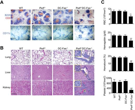 Figure 5. Histochemistry and blood analyses of perforin−/−DC-Fas−/− mice. (A) Spleen sections of 7-week-old perforin−/−DC-Fas−/− and control mice were stained with anti-CD3 and anti-B220, or anti-CD11c. Scale bar: 50 μm. (B) Section of lung, liver, and kidney from 7-week-old perforin−/−DC-Fas−/− and control mice were used for H&E staining. Scale bar: 50 μm. (C) Blood analyses of 7-week-old perforin−/−DC-Fas−/− and control mice. WT versus perforin−/−DC-Fas−/−: **P < .01 (n = 5).