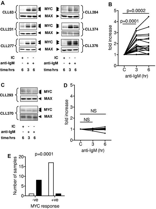 Figure 1. Induction of MYC protein after sIgM stimulation in CLL samples. (A,C) CLL samples were incubated with anti-IgM for 3 or 6 hours or for 6 hours with the isotype control antibody (IC). Expression of MYC and MAX protein was analyzed by immunoblotting. Results shown are representative of those obtained from analysis of 18 intracellular Ca2+-responsive (A) and 9 intracellular Ca2+ nonresponsive (C) CLL samples. MAX expression demonstrates equal loading of protein samples. (B,D) Quantitation of the fold increase in MYC protein expression (relative to isotype-control treated cells; C) measured by densitometry analysis of immunoblots at 3 or 6 hours after stimulation with anti-IgM for intracellular Ca2+-responsive (B) and -nonresponsive (D) samples. Graphs show data for individual samples, and any statistically significant differences (Student matched paired t test) between control and anti-IgM–stimulated cells (NS indicates not significant, P > .05). (E) Comparison between MYC induction (> 20% increase compared with control cells) and positive (□) and negative (■) intracellular Ca2+ responses (Fisher exact test) in anti-IgM–treated CLL samples (n = 27).