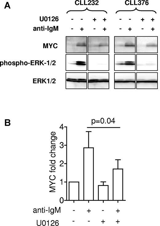 Figure 4. Effect of U0126 on MYC induction. Cells were stimulated with anti-IgM for 3 hours in the presence of U0126 (10μM) or DMSO as a control. (A) Expression of MYC and phosphorylated and total ERK1/2 was analyzed by immunoblotting. Two representative samples are shown of a total of 5 samples analyzed. Note that intervening lanes were removed for clarity, and the complete blot is shown in supplemental Figure 1D. (B) Quantitation of MYC expression. Graphs show mean (± SEM) MYC expression relative to untreated cells (set to 1.0), derived from 5 independent experiments. The reduction in MYC expression in cells treated with anti-IgM and U0126 was statistically significant compared with cells treated with anti-IgM alone (Student matched pairs t test).