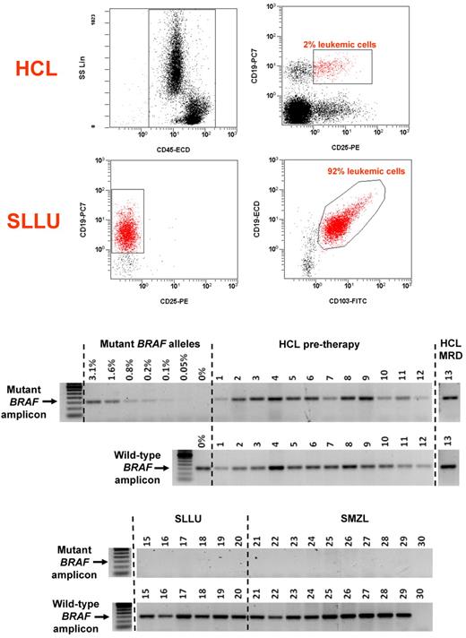 Figure 1. Flow cytometry and AS-PCR assays in HCL and HCL-like disorders. (Top panel) Flow cytometry dot plots of a whole-blood sample subjected to RBC lysis from a representative HCL patient (top graphs) and of purified peripheral blood leukemic cells from a representative patient with HCL-v (bottom graphs). HCL cells (CD19+/CD25+ red events in the top right panel) represent 2% of all nucleated cells (CD45+ black events in the top left panel). HCL-v cells (CD19+/CD25− and CD19+/CD103+ red events in the bottom left and right panels, respectively) represent 92% of all cells. (Bottom panel) Conventional agarose-gel electrophoresis of samples from 13 HCL patients (top panels; 12 pretreatment, 1 with residual disease after treatment) and 16 HCL-like patients (bottom gels; 6 SLLU, 10 SMZL), after AS-PCR for the mutant allele (1st and 3rd gel from the top) and for the wild-type allele (2nd and 4th gel from the top). In the top-most gels, serial dilutions of mutated and wild-type alleles (from 3.1% to 0% muted alleles) are also included to show the analytical sensitivity of the mutant AS-PCR (≥ 0.1% mutated alleles). All HCL samples gave rise to a mutant BRAF-V600E band as opposed to none of the HCL-like samples. One of the latter (SMZL case 30), which did not give rise to the wild-type band either, was not evaluable in this particular experiment (shown on purpose), but on repetition turned out to be evaluable (ie, strong wild-type band) and negative for BRAF-V600E (ie, mutant band not visible). To facilitate the visualization of the results, the gel lane of HCL case 13 was repositioned in the 2 top gels and the gel lane of the 50-bp DNA ladder was repositioned in the 2 bottom gels.
