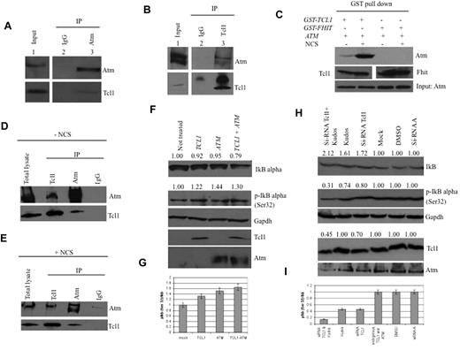 Figure 1. Tcl1 interacts with Atm, and both affect IκBα expression. (A) HEK293 cells were stably transfected with expression plasmid encoding FLAG-ATM and then infected with Ad-TCL1 wild-type (MOI 100). Forty-eight hours after infection, whole-cell lysates were immunoprecipitated with anti-Atm (resin conjugated to Atm). The immunoprecipitates were analyzed by Western blot with anti-Atm or anti-Tcl1. Input: lysate expression of Atm (top) and Tcl1 (bottom). (B) HEK293 cells were transiently cotransfected with expression plasmids encoding mammalian FLAG-ATM (8 μg) and wild-type TCL1 (6 μg). Forty-eight hours after transfection, cell lysates were immunoprecipitated with anti-TCL1. The immunoprecipitates were analyzed by Western blot with anti-Atm or anti-Tcl1. Input: lysate expression of Atm (top) and Tcl1 (bottom). (C) HEK293 cells were transiently cotransfected with expression plasmids encoding mammalian Omni-GST-TCL1 (6 μg) or Omni-GST-FHIT (6 μg) and FLAG-HIS-ATM (8 μg). Forty-eight hours after transfection, cells were treated with neocarzinostatin (NCS) 200 ng/mL for 2 hours. Cell lysates were GST-pulled down and immunoblotted with anti-His6, anti-Tcl1, and anti-Fhit. Input: lysate expression of Atm. (D-E) Daudi cells were untreated or treated with hydroxyurea, 50mM for 3 hours, then lysed and immunoprecipitated, performed with anti-Atm, anti-Tcl1, or IgG. The precipitates were analyzed by Western blot with anti-Atm or anti-Tcl1. (F) Tcl1 and Atm coexpression is associated with decreased IκBα total protein. HEK293 cells were mock-transfected or transfected with TCL1 or ATM plasmids separately or together (4 μg for each plasmid, including empty vector). Forty-eight hours later, cells were treated with hydroxyurea 50mM for 3 hours and then analyzed by Western blot with the indicated antibodies. (G) Tcl1 and Atm coexpression is associated with increased IκBα (Ser32) phosphorylation as shown in the graph. (H) Daudi cells were mock-transfected or transfected with si-TCL1 or si-Scr, and then untreated or treated with Kudos 55933 or DMSO. The level of IκBα was measured by Western blot. (I) IκBα (Ser 32) levels are shown in the graph. Data are representative of 3 independent experiments.