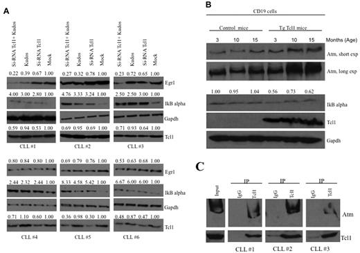Figure 4. Tcl1 and Atm affect the NF-κB pathway in CLL patient samples and Tcl1 transgenic mice. (A) B-CLL samples were transfected with si-TCL1 for 36 hours or treated with Kudos (10μM, 12 hours) or both and in all cases treated with hydroxyurea, 50mM 3 hours. IκBα and Egr1 expression was detected by Western blot. (B) B-cell CD19 isolated from mouse spleen was lysed and analyzed by Western blot with indicated antibodies. Spleens were excised from wild-type and Tcl1 transgenic mice at 3, 10, and 15 months of age. Data are representative of 3 independent experiments. (C) Whole B-CLL cell lysates were immunoprecipitated with anti-Tcl1 antibody. The immunoprecipitates were analyzed by immunoblotting (IB) with anti-Atm and anti-Tcl1 antibodies. Input: total lysate.