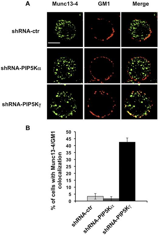 Figure 4. Munc13-4/GM1 colocalization in PIP5Kγ-silenced cells. (A) shRNA-ctr, shRNA-PIP5Kα, and shRNA-PIP5Kγ YTS cells were labeled with Alexa Fluor 594–conjugated CTxB. After fixing and permeabilization, samples were stained with anti–Munc13-4 Ab, followed by Alexa Fluor 350–conjugated secondary Ab. Fluorescent microscopic analysis using the ApoTome system was performed, and representative images of isolated cells are shown as a single optical section. Colocalization of fluorescence signals was analyzed with AxioVision Version 4.6.3 software. Bar represents 10 μm. (B) Percentage of cells showing Munc13-4 and GM1 colocalization was analyzed on randomly acquired fields (n = 80 cells) of each population. Data from 3 independent experiments (means ± SD) are shown.