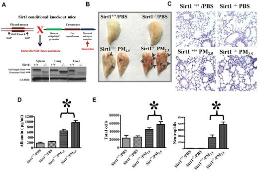 Figure 1. Aggravated lung injury and coagulation in Sirt1 knock-out mice after PM2.5 exposure. (A) To generate inducible Sirt1 knock-out mice, floxed Sirt1 mice containing a loxP-flanked Sirt1 exon 4 were bred with UBC-Cre-ERT2 mice. Tamoxifen-inducible and Cre-mediated recombination resulted in deletion of Sirt1 exon 4. Inducible knock-out mice were given tamoxifen by intraperitoneal injection. Ten days after tamoxifen treatment, spleen, lung, and liver were collected. Tissue homogenates were subjected to immunoblotting to confirm Sirt1 deletion. (B) Sirt1−/− and Sirt1+/+ littermate mice were exposed to PBS or PM2.5 (100 μg) by intranasal instillation. Twenty-four hours later, lungs were perfused with PBS via the right ventricle to remove blood from the vascular bed of the lung. Lung images show that PM2.5 exposure led to blood clot formation (arrows). Images are representative of 6 mice in each experimental group. (C) Histologic examination by H&E staining shows increased leukocyte infiltration and blood clot formation in the lungs of Sirt1−/− mice after PM2.5 exposure. Images are representative of 4 mice in each experimental group. Sirt1+/+ and Sirt1−/− littermates were exposed to PBS or PM2.5 (100 μg) by intranasal instillation. Twenty-four hours later, BAL fluids were collected. (D) BAL albumin levels were assessed by ELISA. (E) Total cells and neutrophils in the BAL fluids were counted by flow cytometry. Data are presented as mean + SEM (n ≥ 7 mice/group; *P < .05).