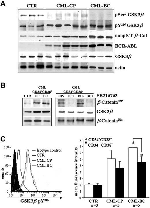 Figure 1. Deregulated GSK3β activation in CD34+ cells isolated from CML patients. (A) Primary CD34+ cells freshly isolated from healthy donors (CTR, n = 3) and CML patients in CP (n = 5) or BC (n = 3) were immunoblotted as indicated. Total levels of BCR-ABL and active β-catenin are also indicated. Total β-actin levels are reported as a loading control. (B) GSK3β was immunoprecipitated from CML progenitors (CD34+CD38+) and more primitive stem cells (CD34+CD38−) pooled from CML patients in CP (n = 5) or BC (n = 3) and incubated with (CP+ and BC+) or without (CP− and BC−) SB216763 5μM for 4 hours. Normal CD34+CD38− cells were pooled from healthy donors (CTR, n = 3). GSK3β activity was examined by an in vitro kinase assay using histidine-tagged recombinant β-catenin (β-CateninHis) as a substrate of GSK3β. Phosphorylated β-catenin was detected by autoradiography (β-Catenin32P). Levels of GSK3β and β-catenin were detected by Western blotting. (C) Representative histogram of intracellular pY216 levels of GSK3β (GSK3β pY216) in CD34+ cells isolated from healthy donors (CTR; n = 3) and CML patients in CP (n = 5) or BC (n = 5). Background signal was assessed in the same populations by staining with a matched-isotype control. Mean fluorescence intensities (MFI) ± SD relative to GSK3β pY216 signal in CD34+CD38+ progenitors and more primitive CD34+CD38− cells from healthy donors (CTR; n = 3) and CML patients in CP (n = 5) or BC (n = 5) are shown. Significant differences in paired t tests for CD34+CD38+ cells versus CD34+CD38− cells in CML BC patients are indicated (*P < .005).