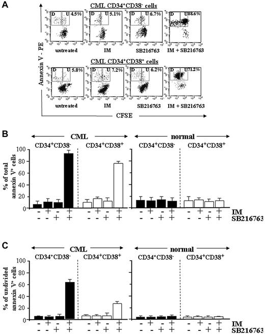 Figure 5. Combined treatment with IM and SB216763 is cytotoxic by inducing apoptosis in CML CP stem/progenitor cells. CML and normal CD34+CD38− primitive and CD34+CD38+ committed progenitors were labeled with CFSE and cultured for 96 hours with IM (1μM), SB216763 (5μM), or the combination. (A) Representative data for apoptosis of CML CD34+CD38− primitive and CD34+CD38+ committed progenitors. (B-C) Compiled data (expressed as percentages of cells positively labeled by annexin V–PE) for apoptosis of total and undivided CML and normal CD34+ cell subsets (n = 5), respectively.
