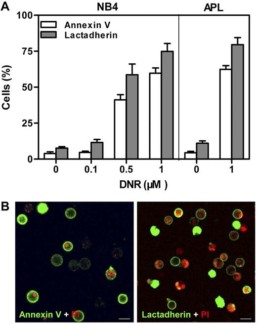 Figure 1. PS exposure of NB4 and APL cells. Cells were costained with PI and either FITC–annexin V or FITC-lactadherin. (A) The cells were incubated with indicated concentrations of DNR for 24 hours. Percentage of annexin V/lactadherin-binding cells was analyzed by flow cytometry. After treatment with 1μM DNR, ∼ 75% of NB4 cells and 80% of APL cells were positive for lactadherin. (B) The plasma membrane of APL cells displayed green fluorescence when stained by FITC–annexin V (left) or FITC-lactadherin (right). Cell nuclei displayed red fluorescence when labeled by PI. Co-stained areas appeared yellow. Scale bars represent 10 μm.