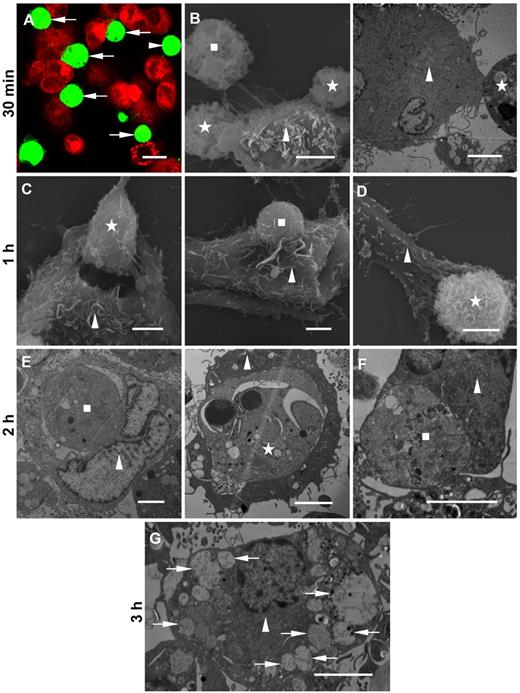Figure 2. Association of target NB4 and APL cells with MΦs. NB4 and APL cells treated with 1μM DNR for 24 hours were used as PS-exposed target cells for all subsequent coculture assays. MΦs were differentiated from monocytes or THP-1 cells. Target cells incubated with MΦs at a 2:1 ratio at 37°C for different times were analyzed. (A) Confocal microscopy image of CMTPX-stained THP-1–derived MΦs (red) with bound CMFDA-labeled target NB4 cells (green, arrows) after 30 minutes of incubation. A scattered target NB4 cell (green, arrowhead). (B) Scanning (left) and transmission (right) electron microscopic examination of anchored (square) and adhered (stars) target APL cells to the surface of THP-1–derived MΦs (triangles) after 30 minutes. (C) After 1-hour incubation, scanning electron microscopy of grasped (left, star) and internalized (right, square) target NB4 cells by THP-1–derived MΦs (triangles). (D) Scanning electron microscopy of a THP-1–derived MΦ (triangle) extending pseudopodia over a target APL cell (star) after 1-hour incubation. (E) After 2 hours of incubation, transmission microscopy of NB4 material (left, square) and a morphologically apoptotic target NB4 cell with karyopyknosis (right, star) engulfed by THP-1–derived MΦs (triangles). (F) Transmission micrograph showing phagocytosed target APL material (square) in a monocyte-derived MΦ (triangle) after 2 hours of incubation. (G) Transmission microscopy image of a THP-1–derived MΦ (triangle) with digested APL apoptotic bodies (arrows) after 3 hours of incubation. Scale bars represent 10 μm (A) or 4 μm (B-G).