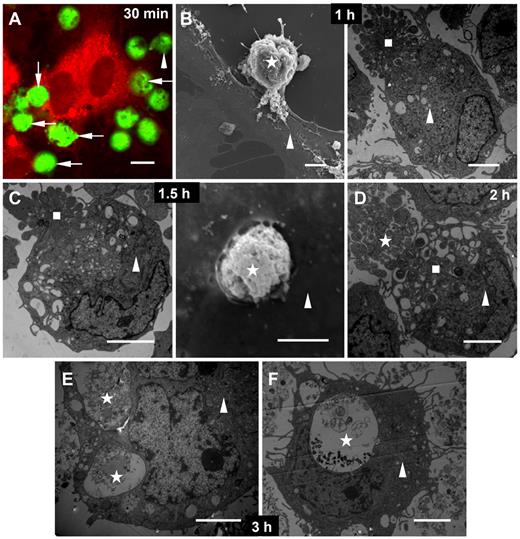 Figure 3. Contact of target NB4 and APL cells with HUVECs. Two-fold target NB4 or APL cells were added to HUVECs at 37°C for various times before the mixed cells were imaged. (A) Confocal image of free (arrowhead) and bound (arrows) CMFDA-labeled target NB4 cells (green) to the membrane of a CMTPX-stained EC (red) after 30 minutes of incubation. (B) After 1-hour coculture, attached target APL cell (left; star; scanning electron microscopy) and target APL cell with apoptotic bodies (right; square; transmission electron microscopy) to the surface of ECs (triangles). (C) A target NB4 cell with apoptotic bodies (left; square; transmission electron microscopy) and a target APL cell (right; star; scanning electron microscopy) trapped by ECs (triangles) after 1.5 hours of incubation. (D) Transmission microscopic image of several separated apoptotic bodies of APL cells (square) in an EC (triangle) and another target APL cell with apoptotic bodies (star) bound to this EC after 2-hour incubation. (E-F) Transmission micrographs showed target APL cells (stars) undergoing degradation in ECs (triangles) after 3 hours. Scale bars represent 10 μm (A) or 4 μm (B-F).