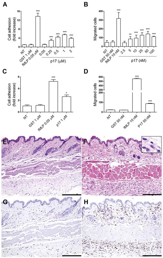 Figure 1. P17 induces the adhesion, migration, and transmigration of isolated human monocytes. (A) Static adhesion assay on fibrinogen. Monocytes were stimulated for 2 minutes at 37°C with PBS (NT), GST, fMLP, or p17 at the indicated concentrations. Bars represent the means ± SD of 3 independent experiments performed in triplicate. Statistical analysis was performed by 1-way ANOVA and the Bonferroni posttest was used to compare data. ***P < .001 compared with NT. (B) Transwell migration assay of monocytes in response to PBS (NT), GST, fMLP, or p17 at the indicated concentrations. Bars represent the means ± SD of 3 independent experiments performed in duplicate. Statistical analysis was performed by 1-way ANOVA and the Bonferroni posttest was used to compare data. **P < .01 and ***P < .01 compared with NT. (C) Static adhesion assay on HUVECs. Monocytes were stimulated for 30 minutes at 37°C with PBS (NT), GST, fMLP, or p17. Bars represent the means ± SD of 4 independent experiments performed in duplicate. Statistical analysis was performed by paired 2-tail Student t test. *P < .05 and ***P < .001 compared with NT. (D) Transwell migration assay of monocytes through HUVEC monolayer in response to GST, fMLP, or p17. Bars represent the means ± SD of 3 independent experiments performed in duplicate. Statistical analysis was performed by paired 2-tail Student t test. ***P < .01 compared with NT. (E-H) Serial sections obtained from PBS-injected (left panels) or p17-injected (right panels) mice and stained for H&E (E-F) or anti-Iba1 (G-H). Skin biopsies obtained from p17-injected mice contain a greater number of infiltrating cells compared with mice injected with PBS. Most of the infiltrating cells correspond to large mononuclear cells (F insert), as defined by the expression of the monocyte/macrophage marker Iba1 (H). Scale bar indicates 200 μm.