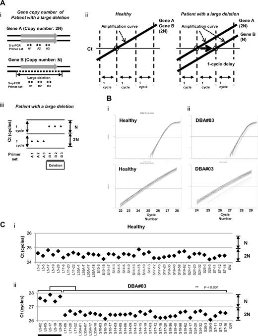Figure 1. s-q-PCR can determine a large gene deletion in DBA. (A) Concept of the DBA s-q-PCR assay. The difference in gene copy number between a healthy sample and that with a large deletion is 2-fold (i). When all genomic s-q-PCR for genes of interest synchronously amplify DNA fragments, a 2-fold difference in the gene copy number is detected by a 1-cycle difference of the Ct scores of the s-q-PCR amplification curves (ii). Also shown is a dot plot of the Ct scores (iii). (B) Results of the amplification curves of s-q-PCR performed with a healthy person (i) and a DBA patient (patient 3; ii). The top panel shows the results of PCR cycles; the bottom panel is an extended graph of the PCR cycles at logarithmic amplification. (C) Graph showing Ct scores of s-q-PCR. If all specific primer sets for DBA genes show a 1-cycle delay relative to each other, this indicates a large deletion in the gene. Gene primer sets with a large deletion are underlined in the graph. **P < .001.