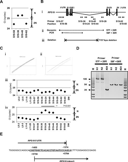 Figure 4. Result of s-q-PCR gene copy number assay for patient 24. (A) Results of s-q-PCR gene copy number assay for RPS19 with 4 primer sets. (Bi) The RPS19 gene copy number was analyzed with 9 specific primer sets for RPS19 that span from the 5′UTR to the 3′UTR. (ii) Primer positions of genomic PCR for RPS19. (iii) Region determined to be an intragenic deletion in RPS19. (C) Results of gene copy number assay for RPS19 show a healthy person (i,iii) and a DBA patient (ii,iv), and Ct results are shown (iii-iv). Patient 24 showed a “1-cycle delay” with primers located in the intron 3 region, but other primer sets were normal. (D) Results of genomic PCR amplification visualized by agarose gel electrophoresis to determine the region of deletion. N1 and N2 are healthy samples. *Nonspecific band. (E) Results from the genomic sequence of the 3-kb DNA band from genomic PCR on patient 24 showing an intragenic recombination from −1400 to 5784 (7157 nt) in RPS19. **P < .001.