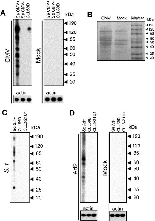 Figure 1. Screening of different bacterial and viral lysates for reactivity with CLL rAbs by immunoblot. (A) CMV- and mock-infected cells were both harvested at 96 hours p.i. for Western blot analysis with the CLL rAbs CLL69D. Human sera (Se CMV+ and Se CMV−) served as positive and negative controls, respectively. All bacterial and viral lysates were used at the same total protein concentration, and all experiments with virus- and mock-infected cell lysates were done in parallel on the same blot, respectively. (B) Visualization of protein bands on the nitrocellulose membranes after electrophoresis and protein transfer of CMV- and mock-infected cell lysates, respectively, with the use of Ponceau S staining solution. (C) Salmonella Typhimurium (St) was harvested after overnight incubation in Luria broth for Western blot analysis with the CLL rAbs CLL69D and CLL3-21U1. Immune serum (Se St+) served as positive control. (D) Ad2 or mock-infected A549 (Mock) cells were harvested at 48 hours p.i. for Western blot analysis with the CLL rAbs CLL69D and CLL3-21U1. Immune serum (Se Ad+) served as positive control. Experiments with mock- and adenovirus-infected cells were done in parallel on the same blot, respectively. Human sera without reactivity to any of the proteins present in the Salmonella Typhimurium or Ad2 lysates were not available, and all CMV reference sera used showed reactivity with several of the proteins (data not shown) because of extensive cross-reactivity between different serotypes. Actin served as loading control. The culture medium used for propagation of Salmonella Typhimurium was protein- and eukaryotic cell-free; therefore, probing with an actin-specific Ab was not done.