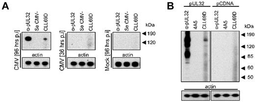 Figure 2. Identification of the CMV protein reactive with the CLL rAb CLL69D. (A) Time course experiment for presence of the 150-kDa CMV protein detected by CLL69D at early and late times during CMV infection of permissive cells. CMV-infected cells were harvested at 36 and 96 hours p.i. for Western blot analysis with the CLL rAbs CLL69D. A monoclonal Ab specific for pUL32 (α-pUL32) and CMV-negative serum (Se CMV−) served as positive and negative controls, respectively. (B) The CMV large structural phosphoprotein pUL32 (pp150) was generated recombinantly for Western blot analysis with the CLL rAb CLL69D. A monoclonal Ab specific for pUL32 (α-pUL32) and a humanized mouse monoclonal Ab of irrelevant specificity (4A5) served as positive and negative controls, respectively. Actin served as a loading control.