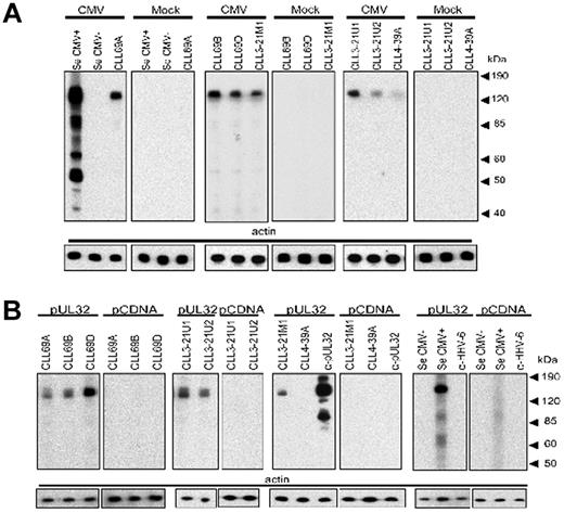 Figure 3. Reactivity of a panel of CLL rAbs with different motifs and light chains to pUL32. Blotting of different stereotypic CLL rAbs with IGHV1-69 (CLL69A, CLL69B, and CLL69D), IGHV3-21 (CLL3-21M1, CLL3-21U1, and CLL3-21U2), and IGHV4-39 (CLL4-39A) gene against lysates of CMV- and mock-infected cells (A) and lysates of pUL32- and pCDNA-transfected cells (B). A mAb specific for pUL32 (α-UL32), serum from a CMV-seronegative individual, and a CMV-seropositive individual (Se CMV− and CMV+, respectively), and a mAb specific for the human herpesvirus-6 glycoprotein 60/110 (α–HHV-6) were used as controls. Concentrations of CLL rAbs ranged between 5 and 7.5 μg/mL. Actin served as a control for protein loading.