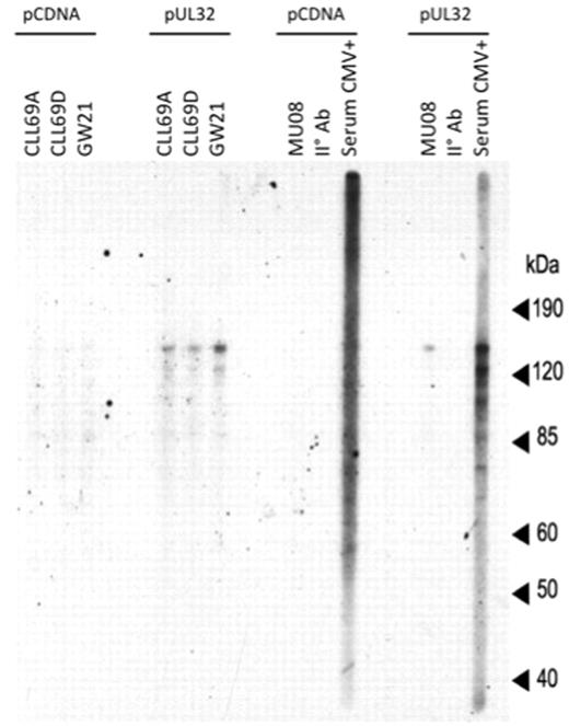 Figure 6. Reactivity of 51p1-encoded Abs isolated from blood of a healthy CMV-seropositive and CMV-seronegative individual with pUL32. Recombinant CMV protein pUL32 and control cell lysate from 293FT cells transfected with pCDNA were size separated on SDS-PAGE and transferred to nitrocellulose membrane. The membrane was probed with CLL 51p1 rAbs and 51p1 rAbs isolated and purified from a healthy CMV-seronegative and CMV-seropositive individual. Secondary Ab alone and CMV-seropositive serum was used as negative and positive control, respectively. All rAbs were tested at the same final concentration (5 μg/mL).