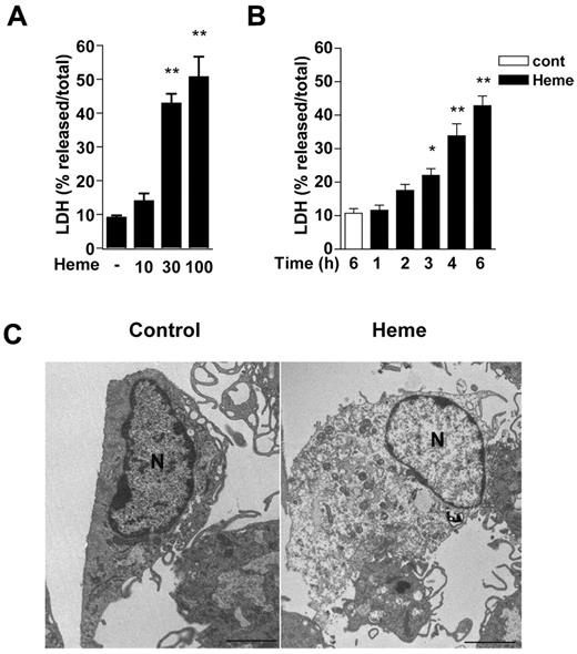 Figure 1. Heme causes macrophage cell death with early loss of plasma membrane integrity and morphologic features of necrosis. Peritoneal macrophages (2 × 105/well) from C57Bl/6 mice were left untreated or stimulated with heme in the absence of serum. Macrophage cell death was dependent on heme concentrations (μM) at 6 hours after stimulation (A), and occurs as early as 3 hours after treatment with heme at 30μM (B). After the indicated time of stimulation with heme, the supernatants were collected for LDH determination. Data are representative of 5 independent experiments performed in triplicates and represent mean ± SEM (*P < .01; **P < .001 compared with control group). (C) Representative transmission electron micrographs of control and heme-treated macrophages (30μM) after 6 hours of stimulation. Scale bars = 2 μm.